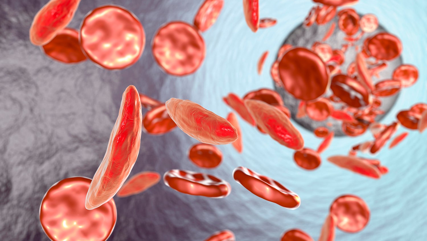 Illustration of sickle cells 