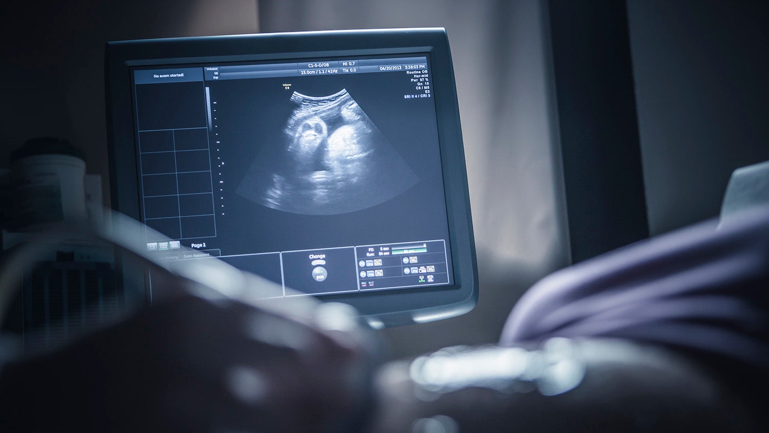 sonogram on pregnant woman at mobile prenatal clinic