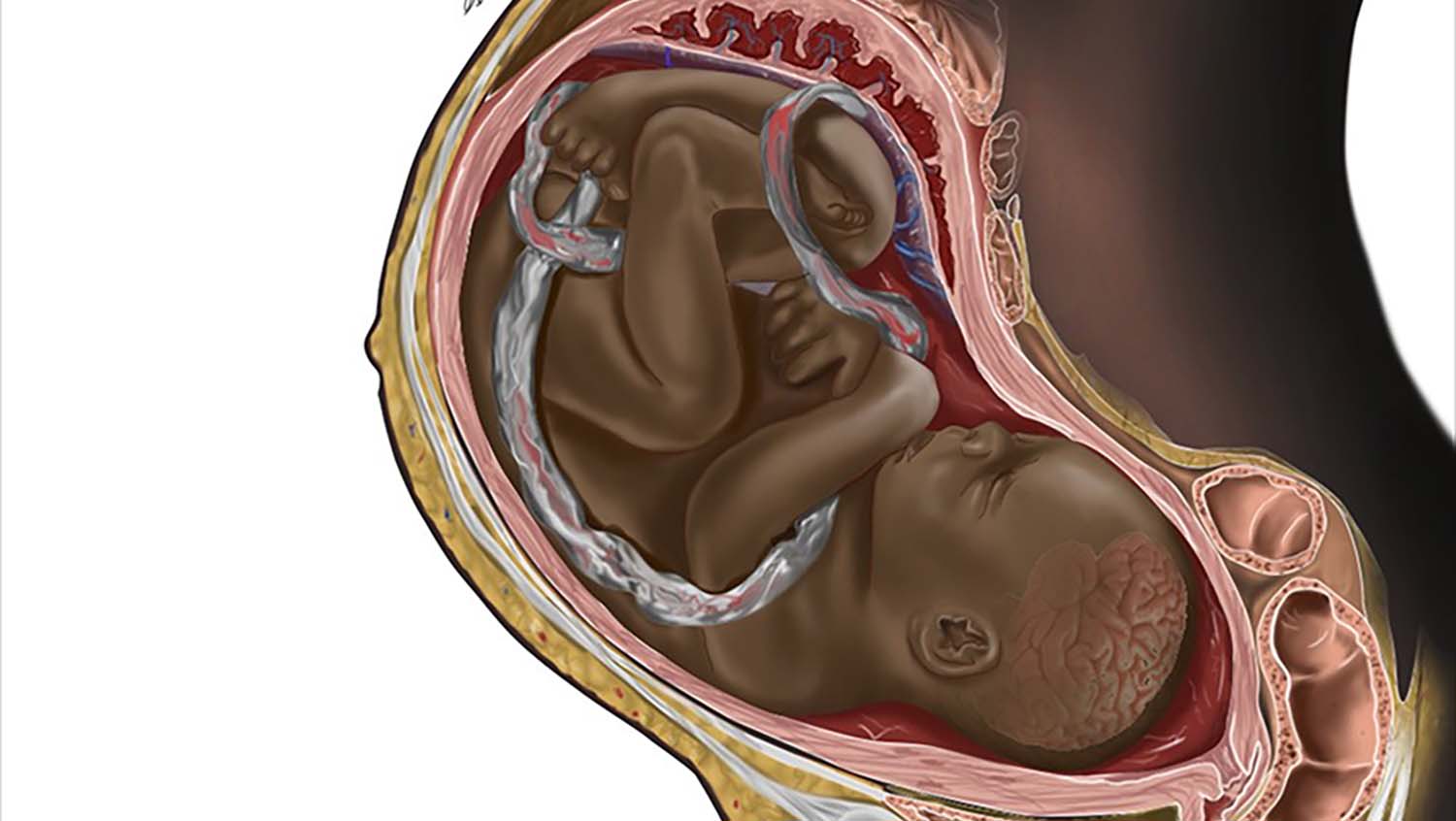 Viral Black Fetus Image Blends Art and Activism