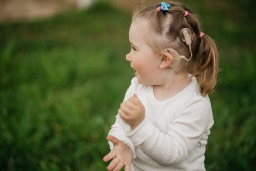 cheerful toddler girl with cochlear implants on the background green grass