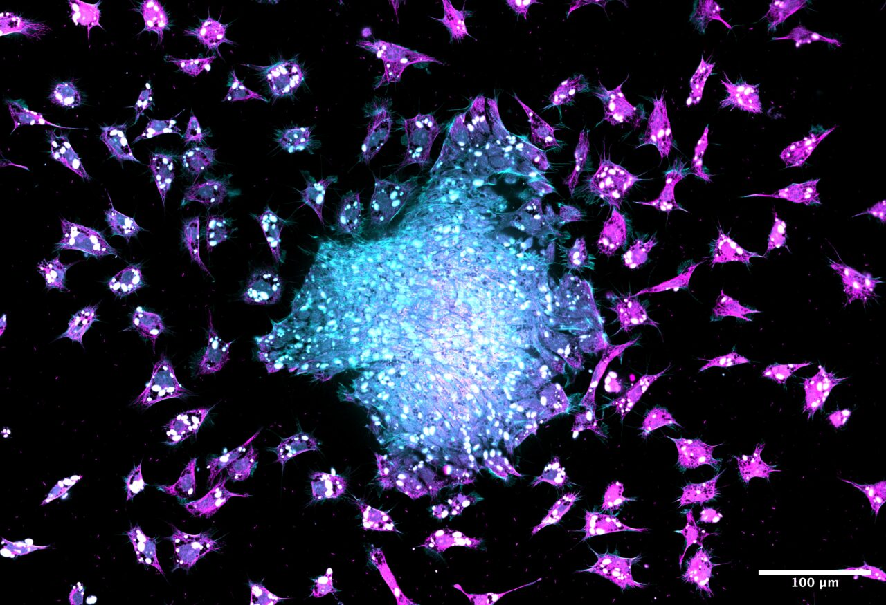 a black background science image with blue and purple cells