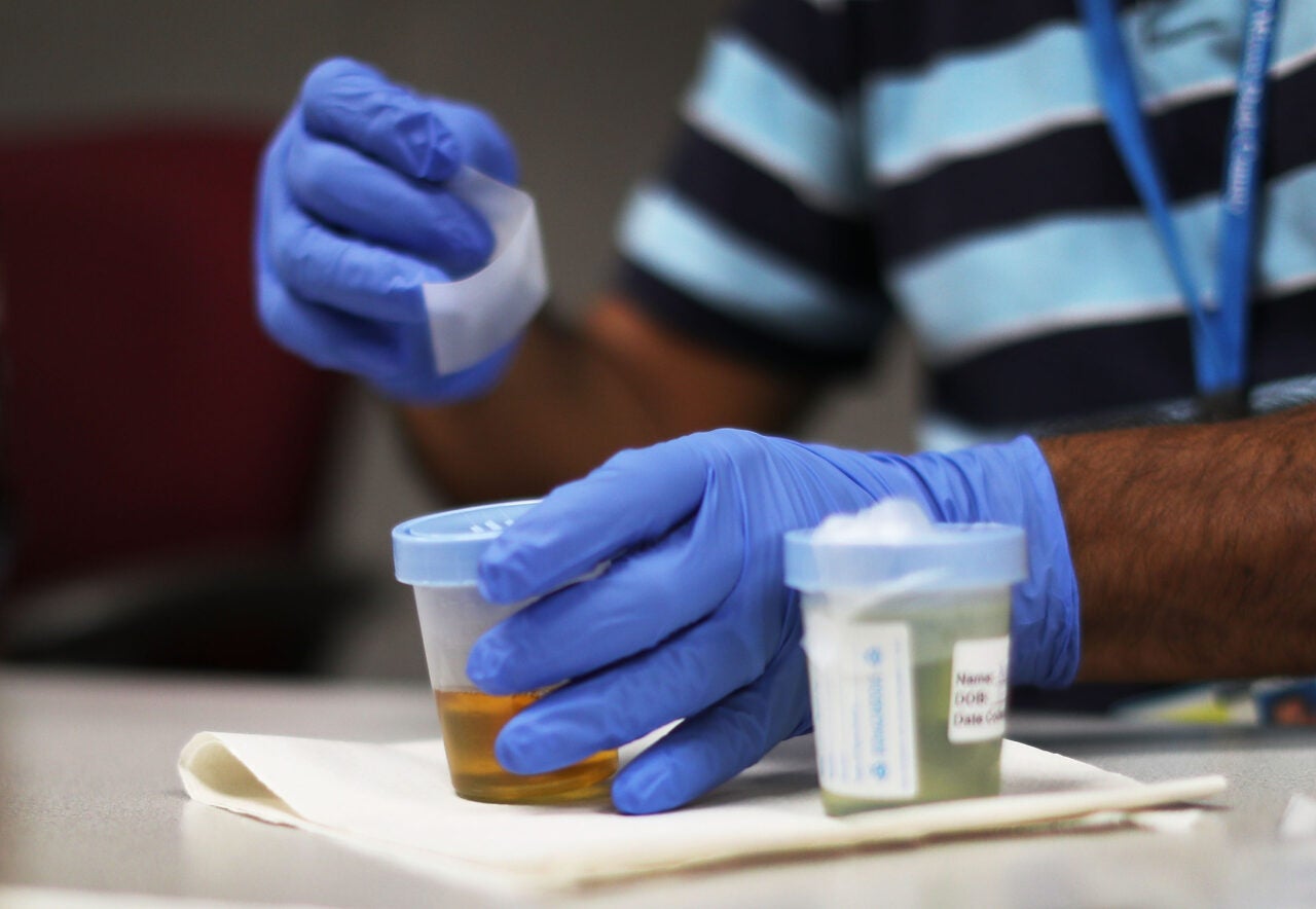 gloved hands covering up a urine test